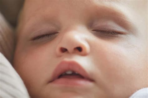 toddler has bags under eyes